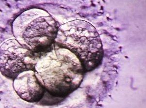 上海同济医院做试管哪个大夫好？